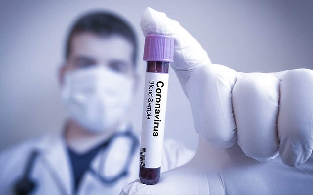 coronavirus test thumb large
